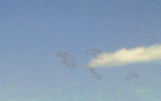 Veo Manchas Transparentes Que Se Mueven